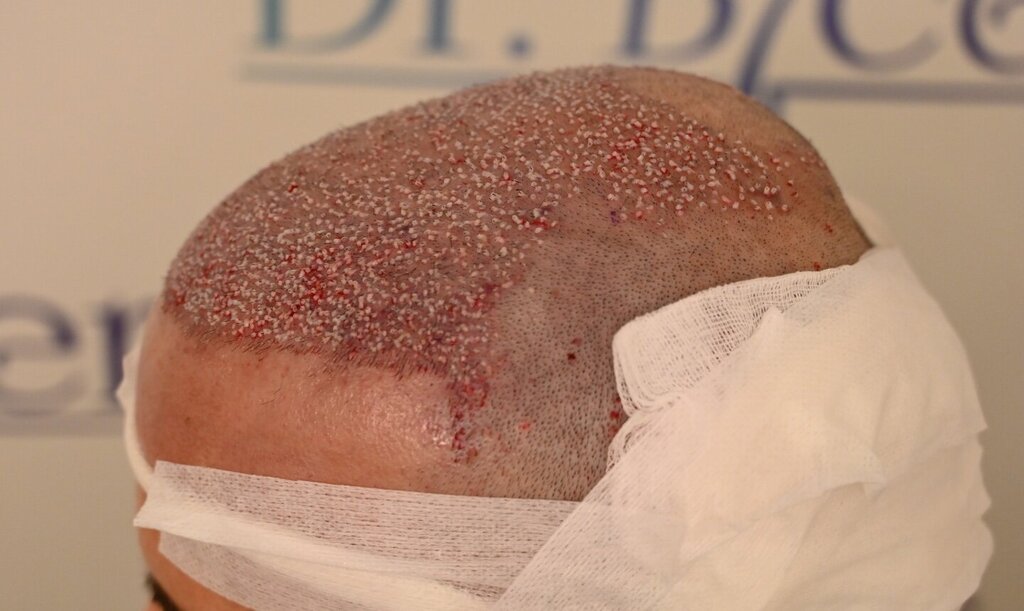 /foren/transplant/index.php/fa/64470/0/