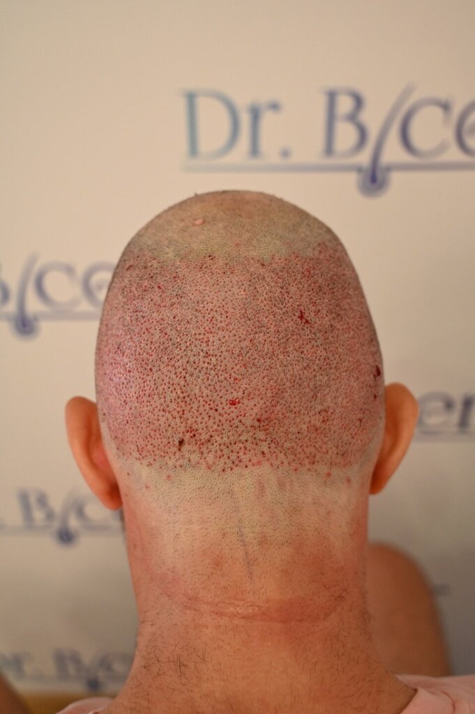 /foren/transplant/index.php/fa/64471/0/