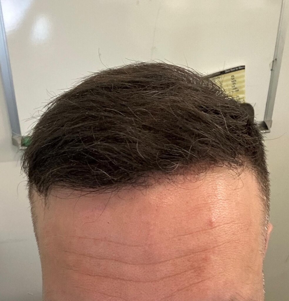 /foren/transplant/index.php/fa/64472/0/