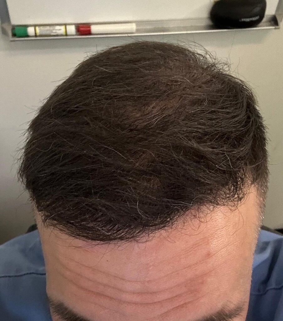 /foren/transplant/index.php/fa/64473/0/