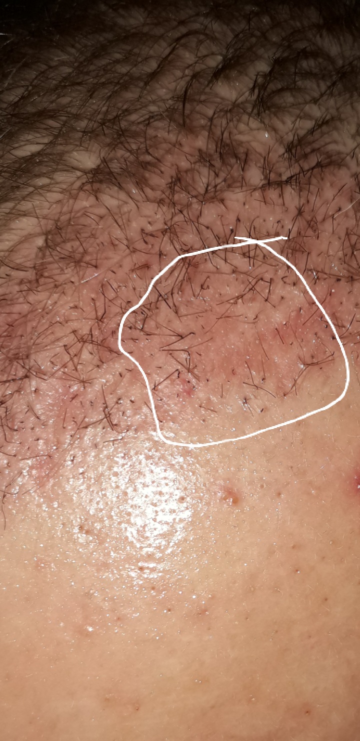 /foren/transplant/index.php/fa/64474/0/