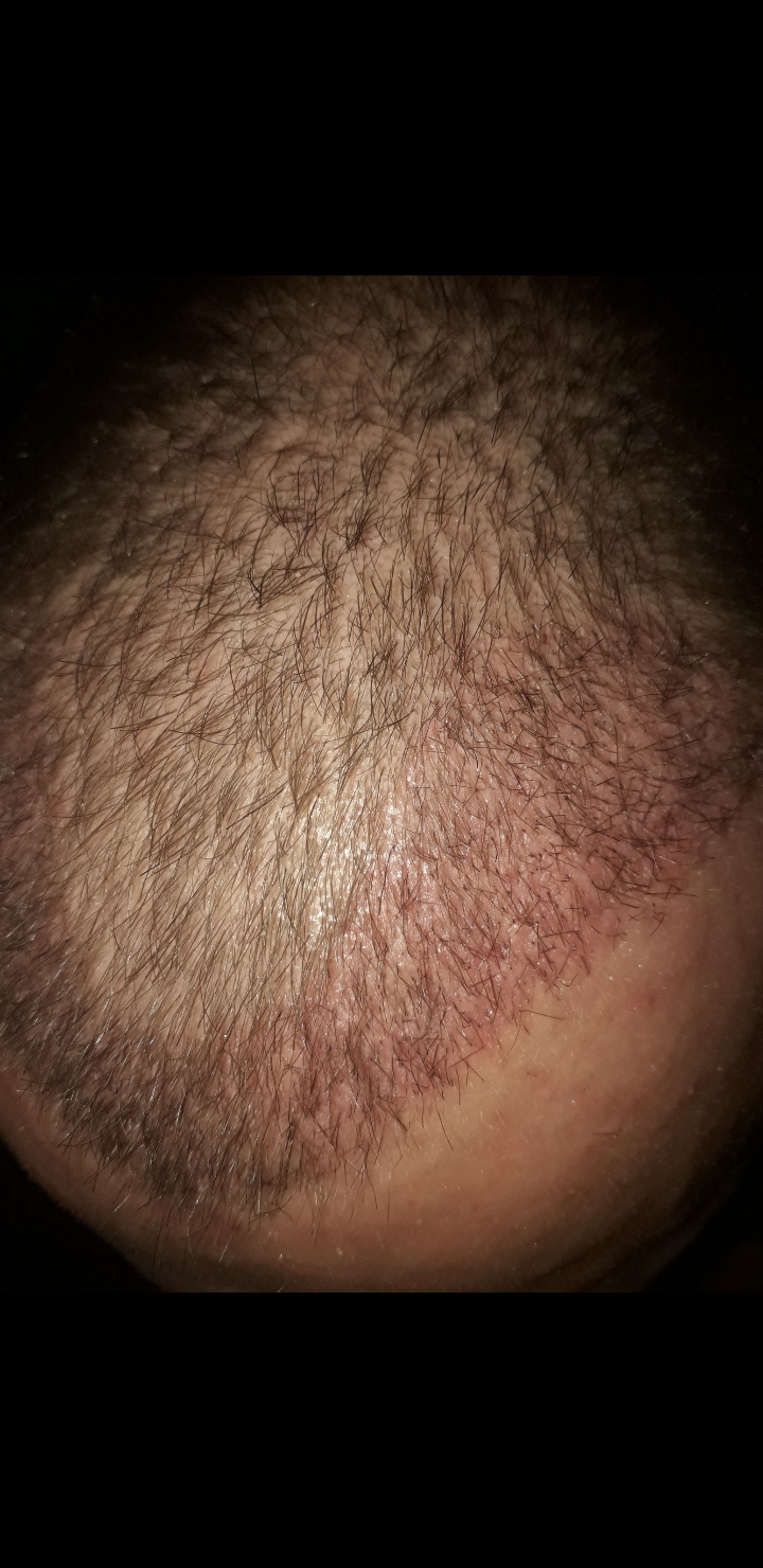 /foren/transplant/index.php/fa/64484/0/