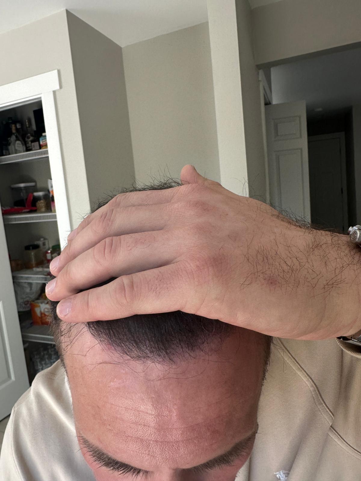 /foren/transplant/index.php/fa/64543/0/