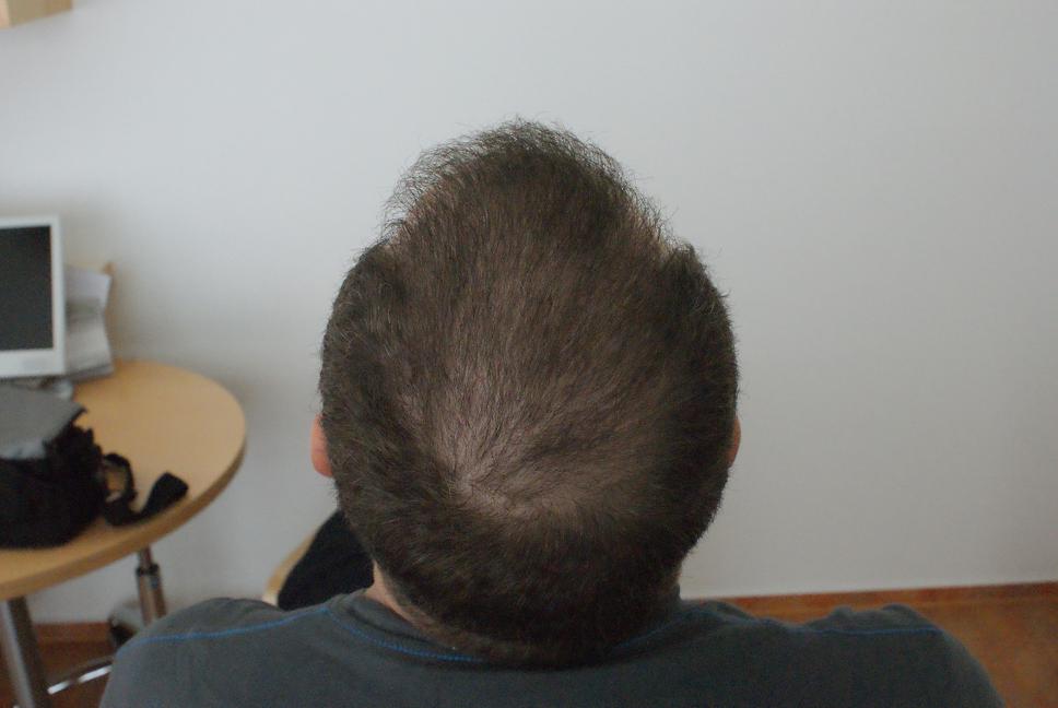 index.php/fa/6455/0/