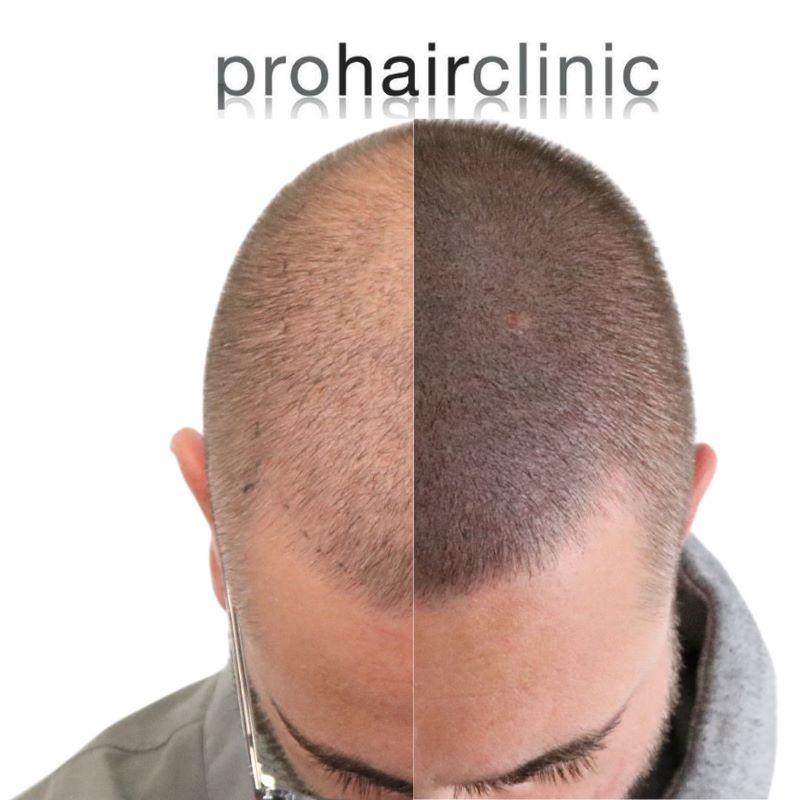 /foren/transplant/index.php/fa/64670/0/