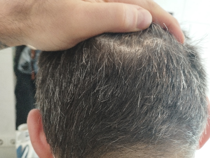 /foren/transplant/index.php/fa/64688/0/','