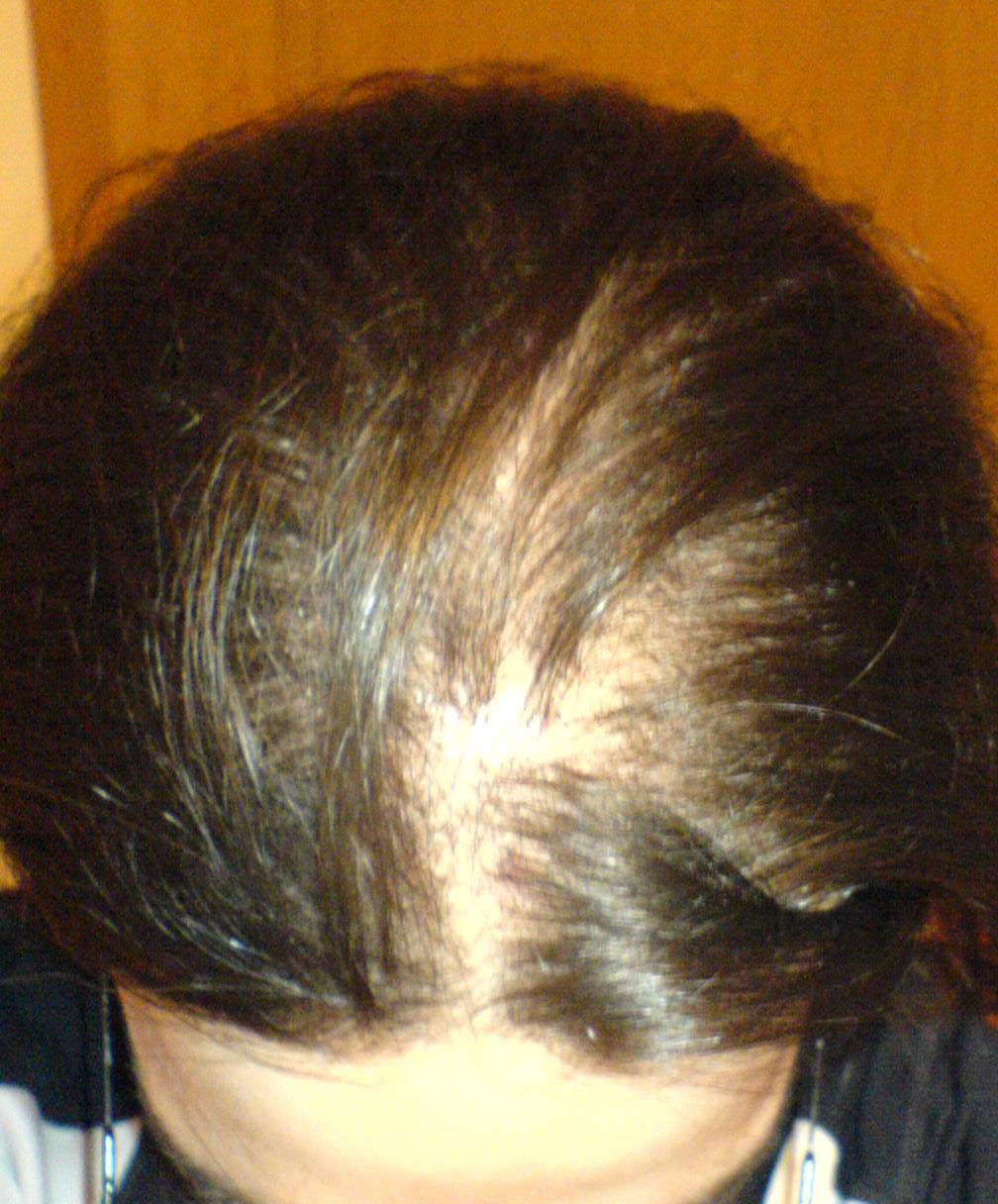 index.php/fa/6479/0/