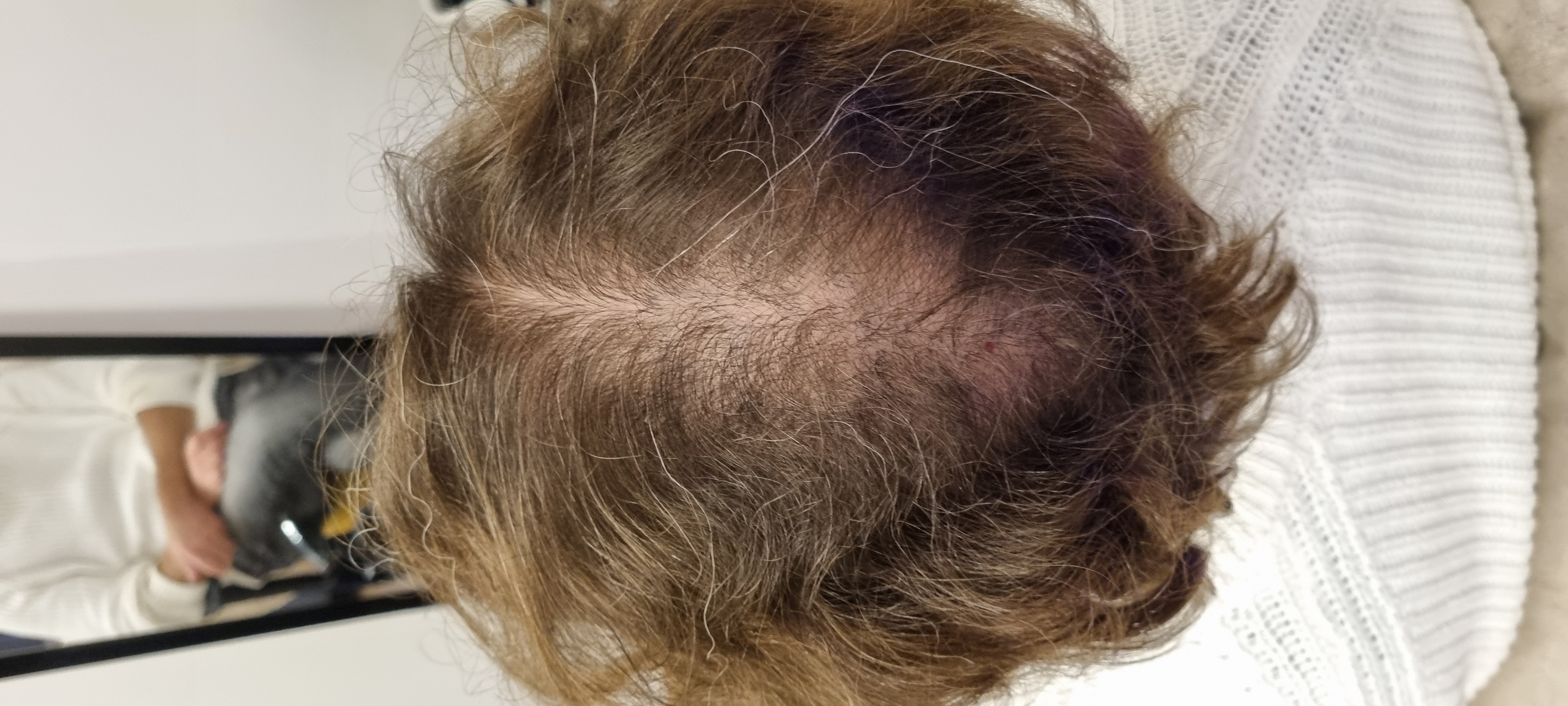 /foren/transplant/index.php/fa/65174/0/