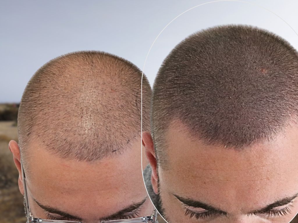 /foren/transplant/index.php/fa/65349/0/