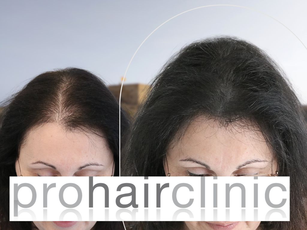 /foren/transplant/index.php/fa/65350/0/