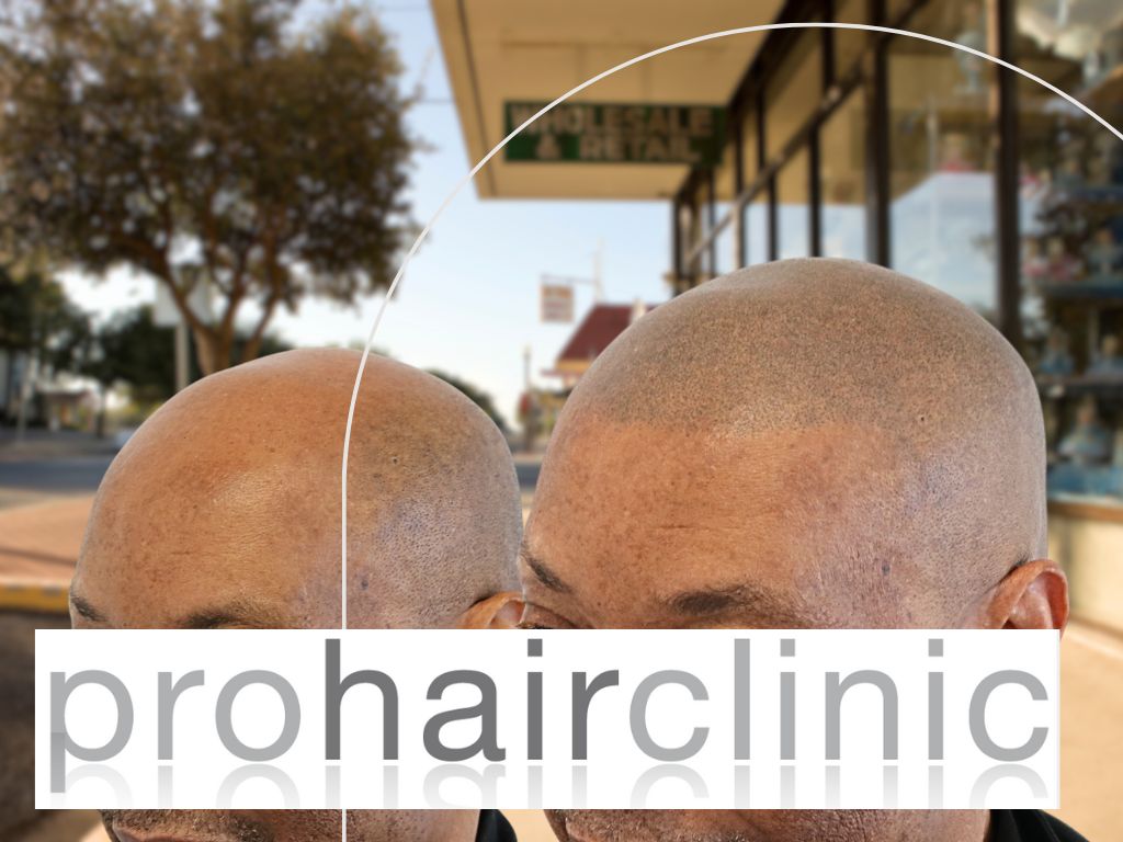 /foren/transplant/index.php/fa/65389/0/