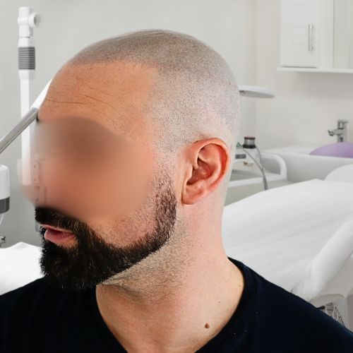 /foren/transplant/index.php/fa/65426/0/