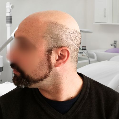 /foren/transplant/index.php/fa/65427/0/