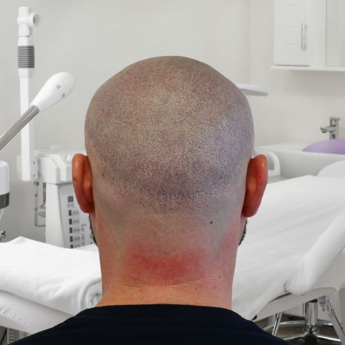 /foren/transplant/index.php/fa/65443/0/