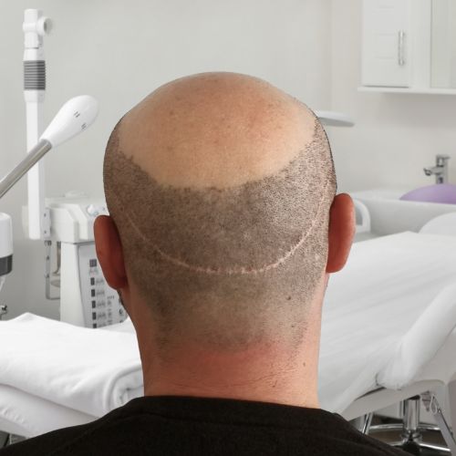 /foren/transplant/index.php/fa/65444/0/