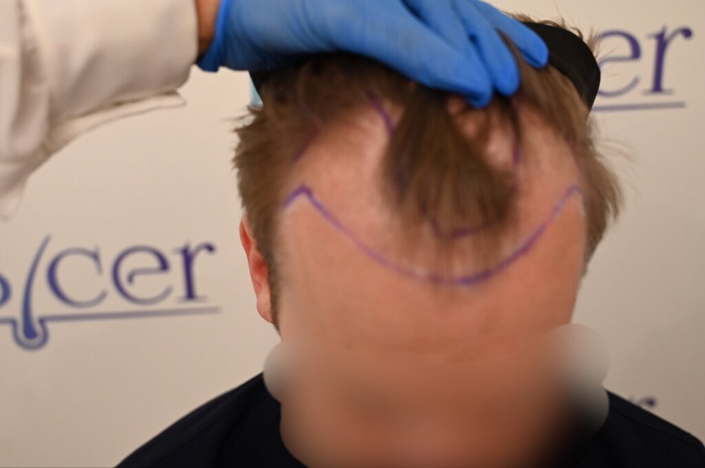 /foren/transplant/index.php/fa/66058/0/