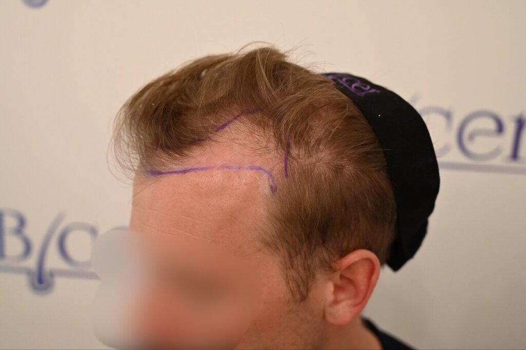 /foren/transplant/index.php/fa/66059/0/