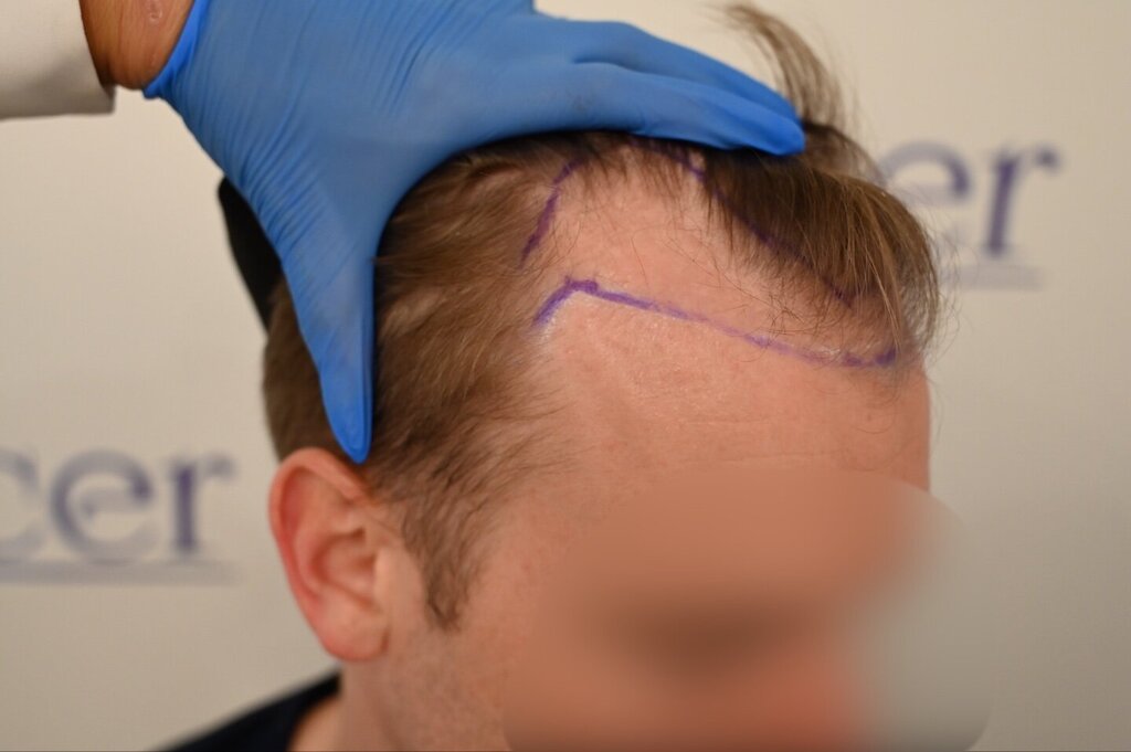 /foren/transplant/index.php/fa/66060/0/