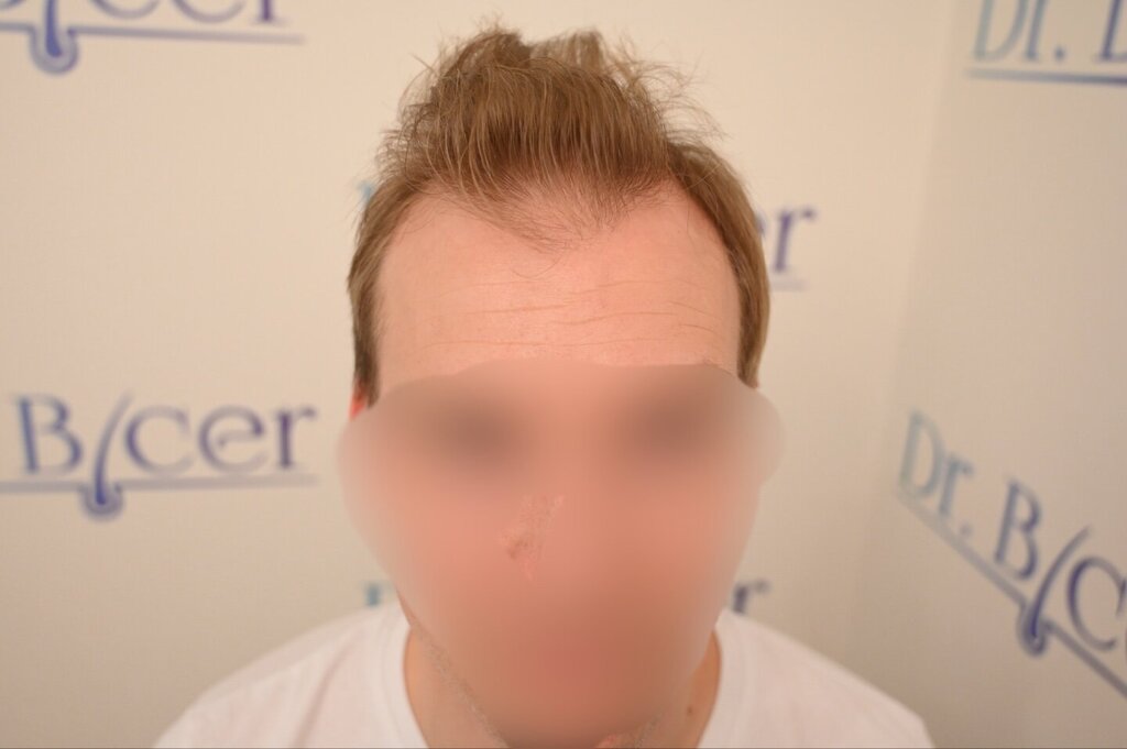 /foren/transplant/index.php/fa/66063/0/