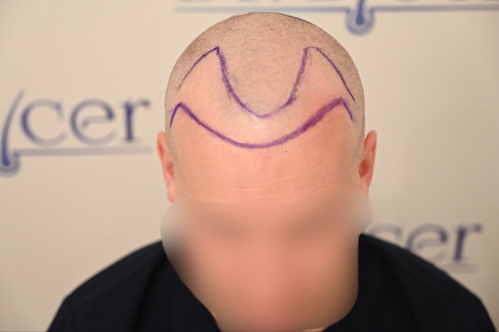 /foren/transplant/index.php/fa/66064/0/