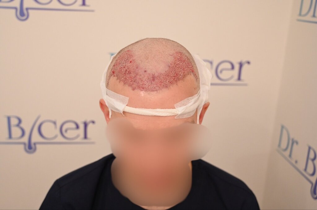 /foren/transplant/index.php/fa/66065/0/