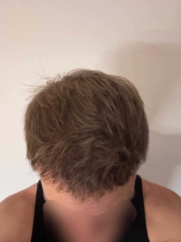 /foren/transplant/index.php/fa/66066/0/