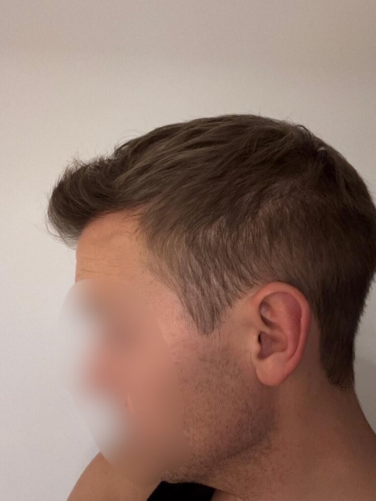 /foren/transplant/index.php/fa/66067/0/