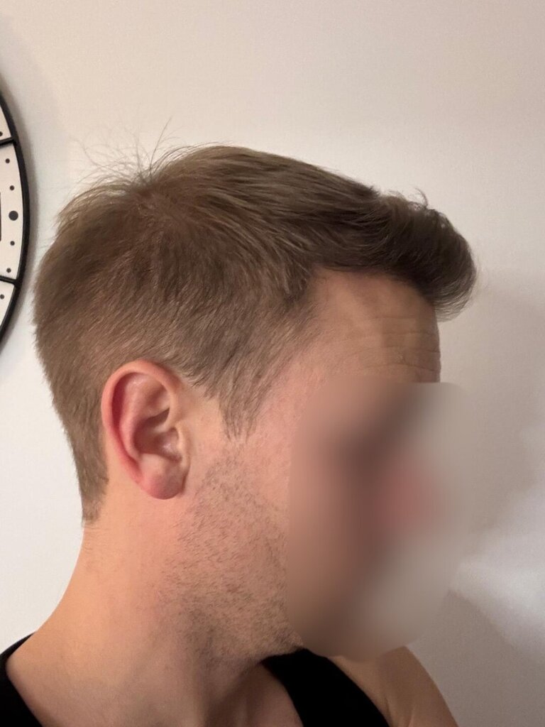 /foren/transplant/index.php/fa/66068/0/