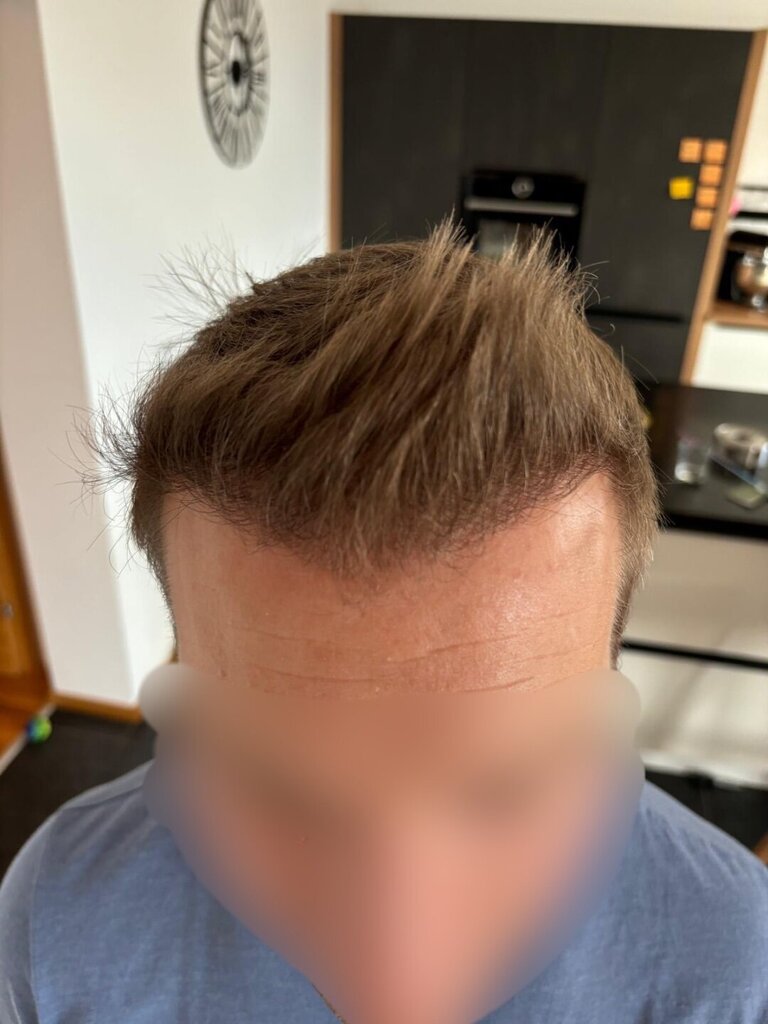 /foren/transplant/index.php/fa/66069/0/