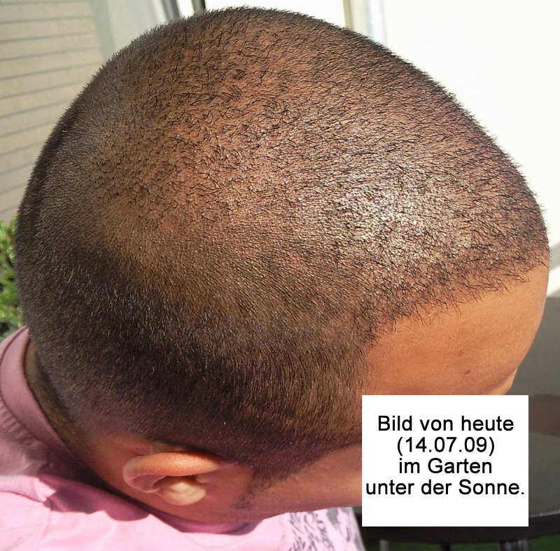 index.php/fa/6611/0/