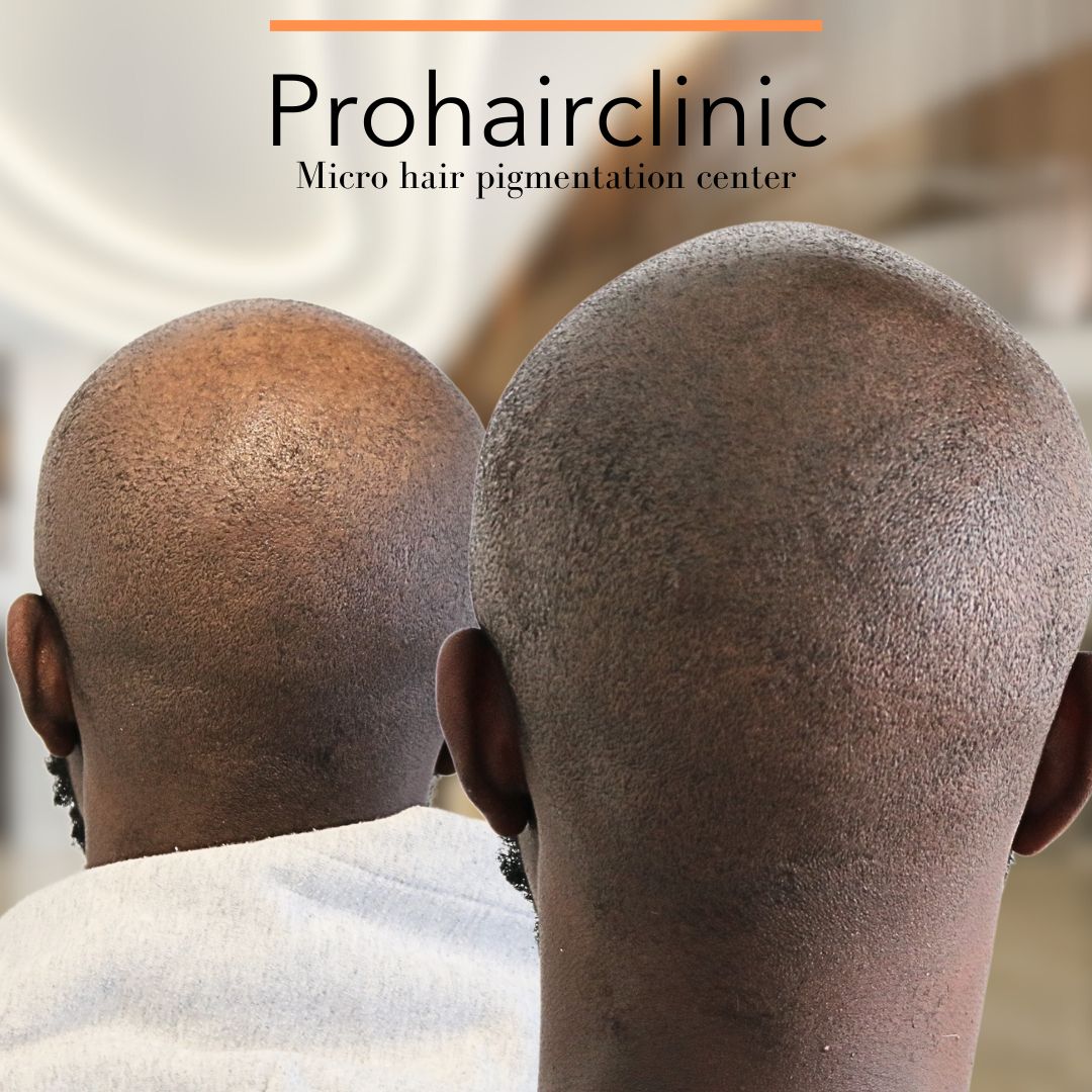 /foren/transplant/index.php/fa/66240/0/