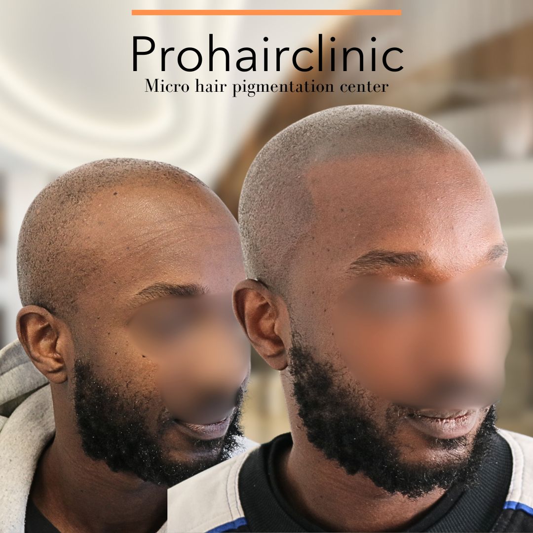 /foren/transplant/index.php/fa/66242/0/