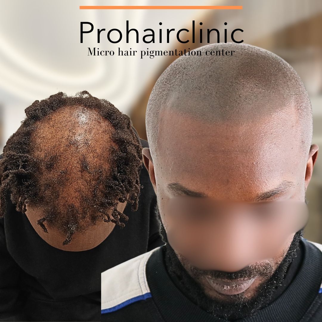 /foren/transplant/index.php/fa/66243/0/