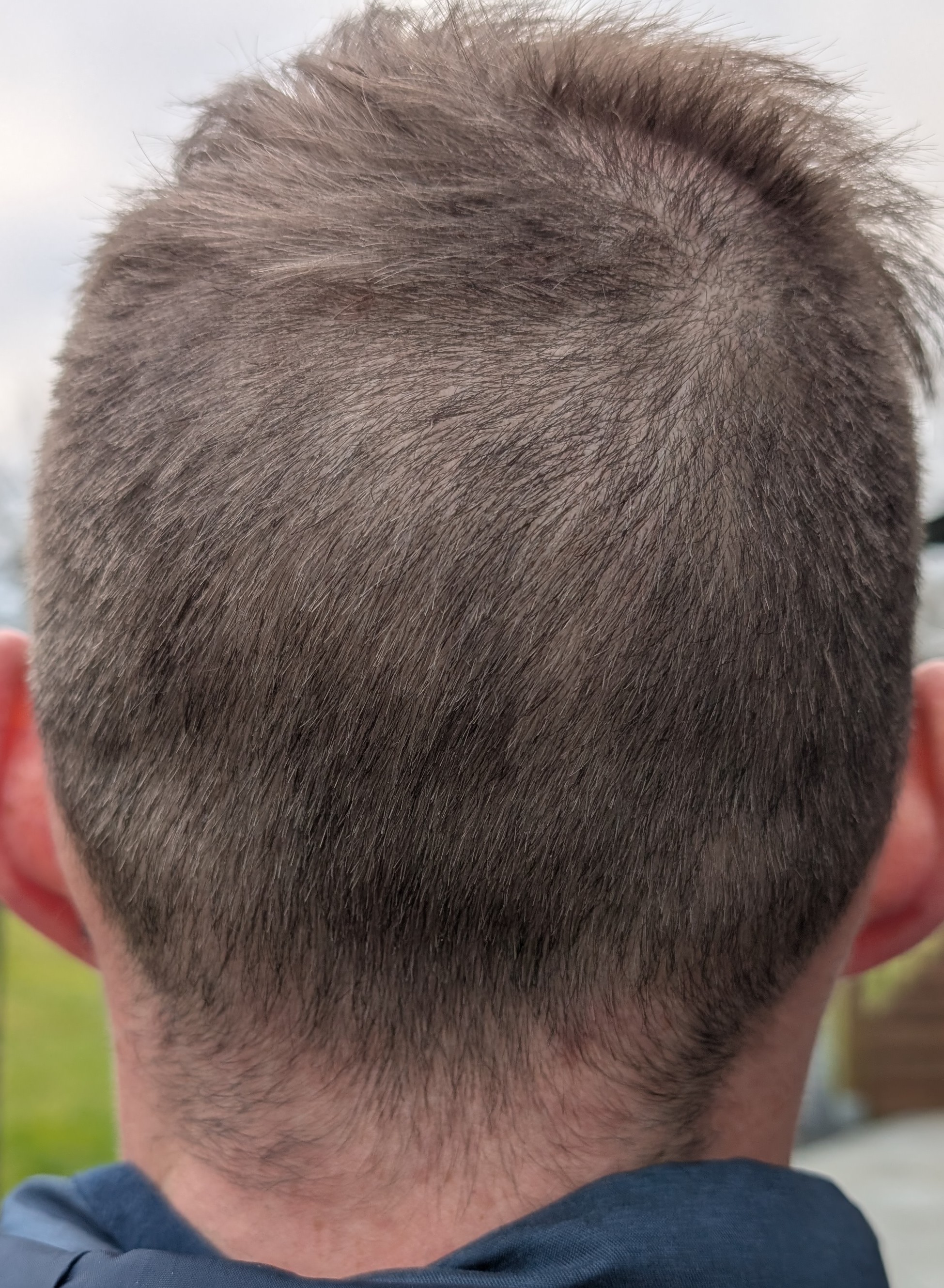 /foren/transplant/index.php/fa/66273/0/