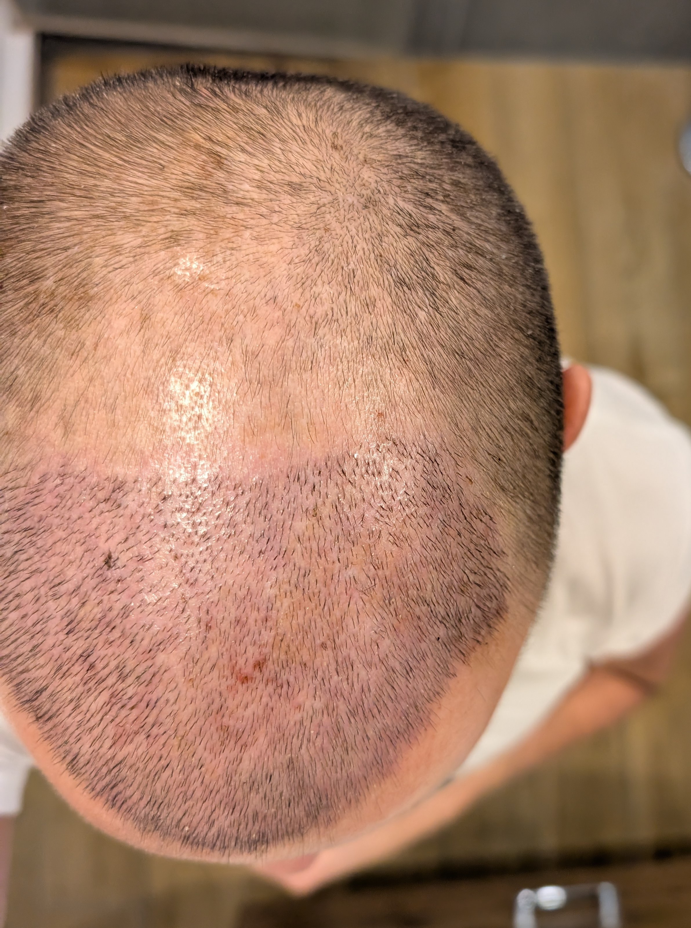 /foren/transplant/index.php/fa/66274/0/