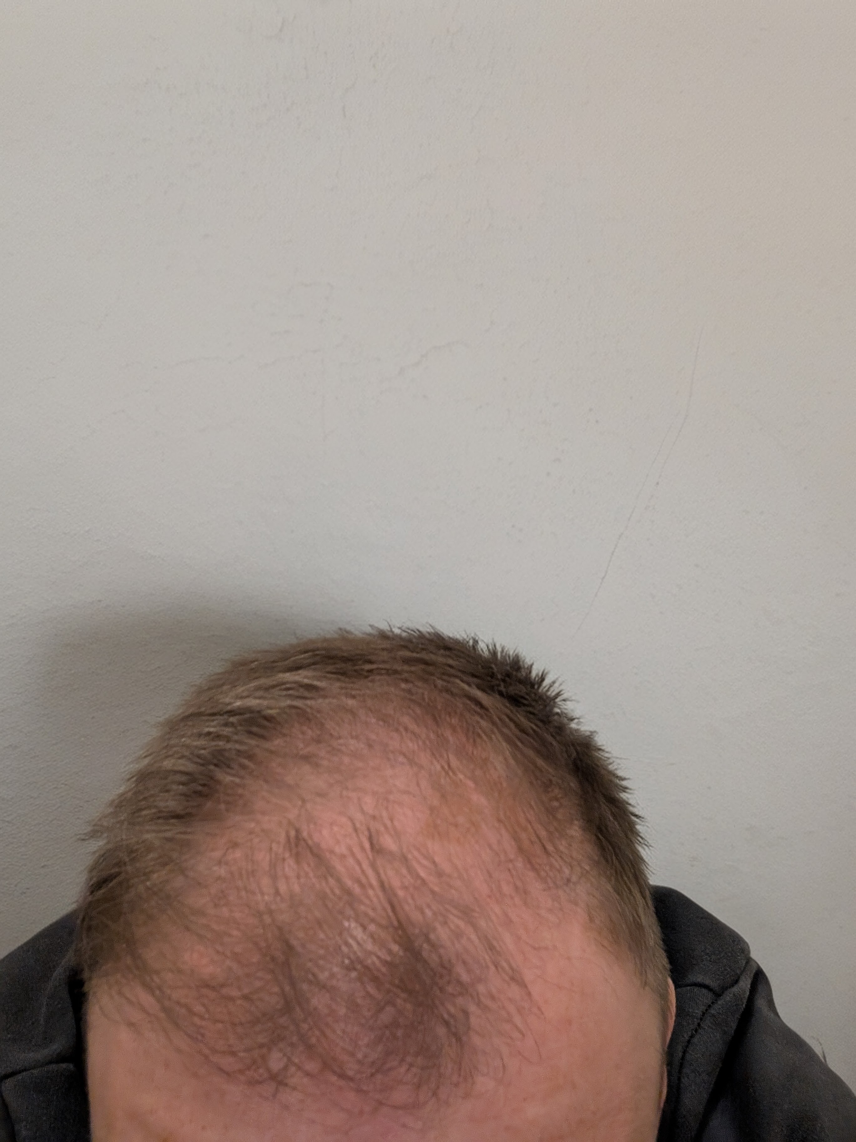 /foren/transplant/index.php/fa/66275/0/