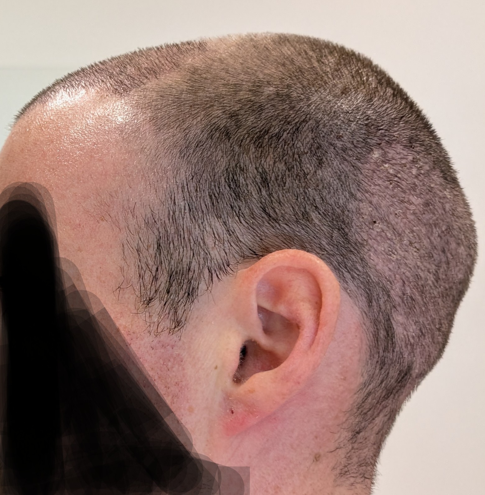 /foren/transplant/index.php/fa/66278/0/