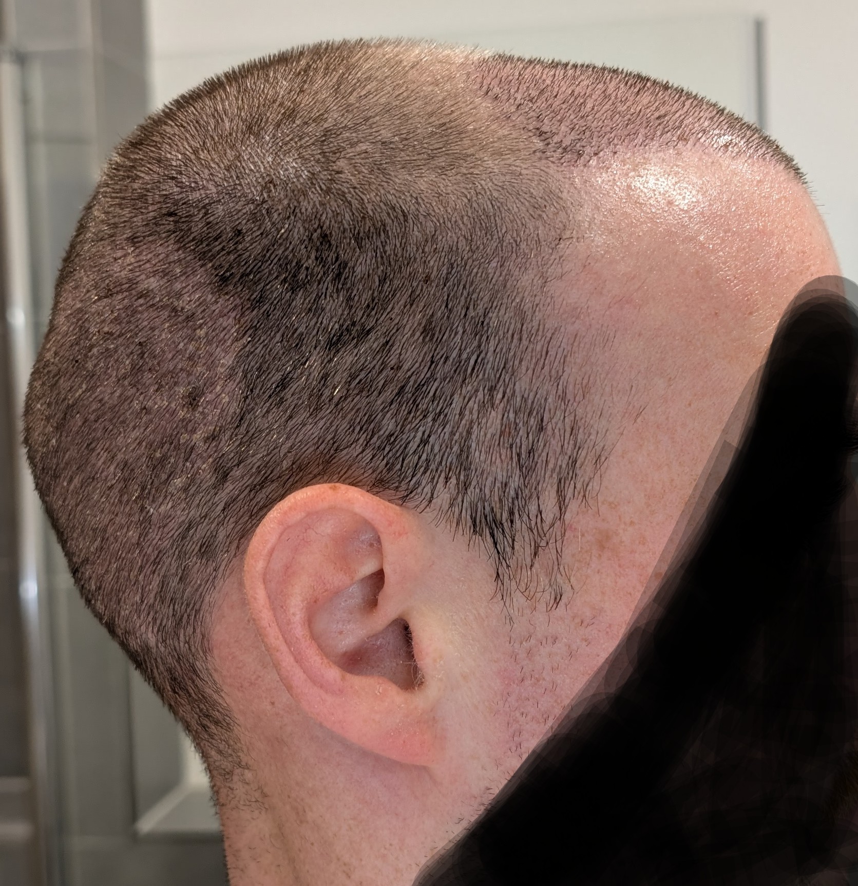 /foren/transplant/index.php/fa/66279/0/