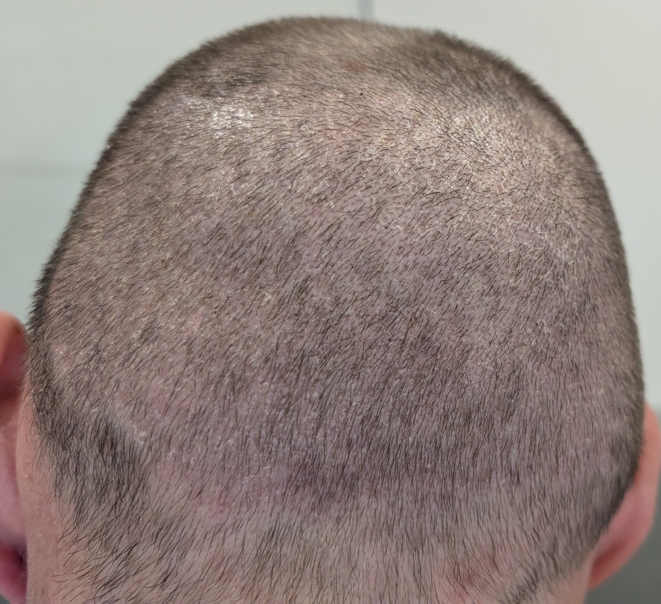 /foren/transplant/index.php/fa/66280/0/