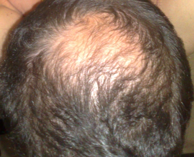 index.php/fa/6638/0/