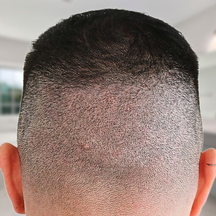 /foren/transplant/index.php/fa/66444/0/