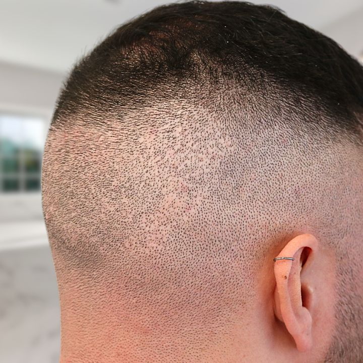 /foren/transplant/index.php/fa/66445/0/