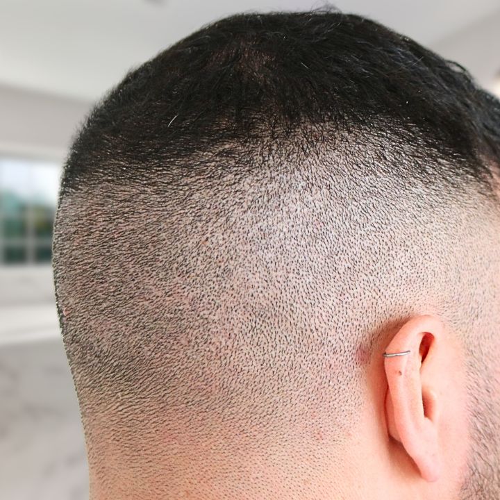 /foren/transplant/index.php/fa/66446/0/