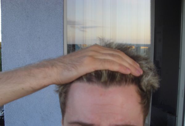 index.php/fa/6717/0/