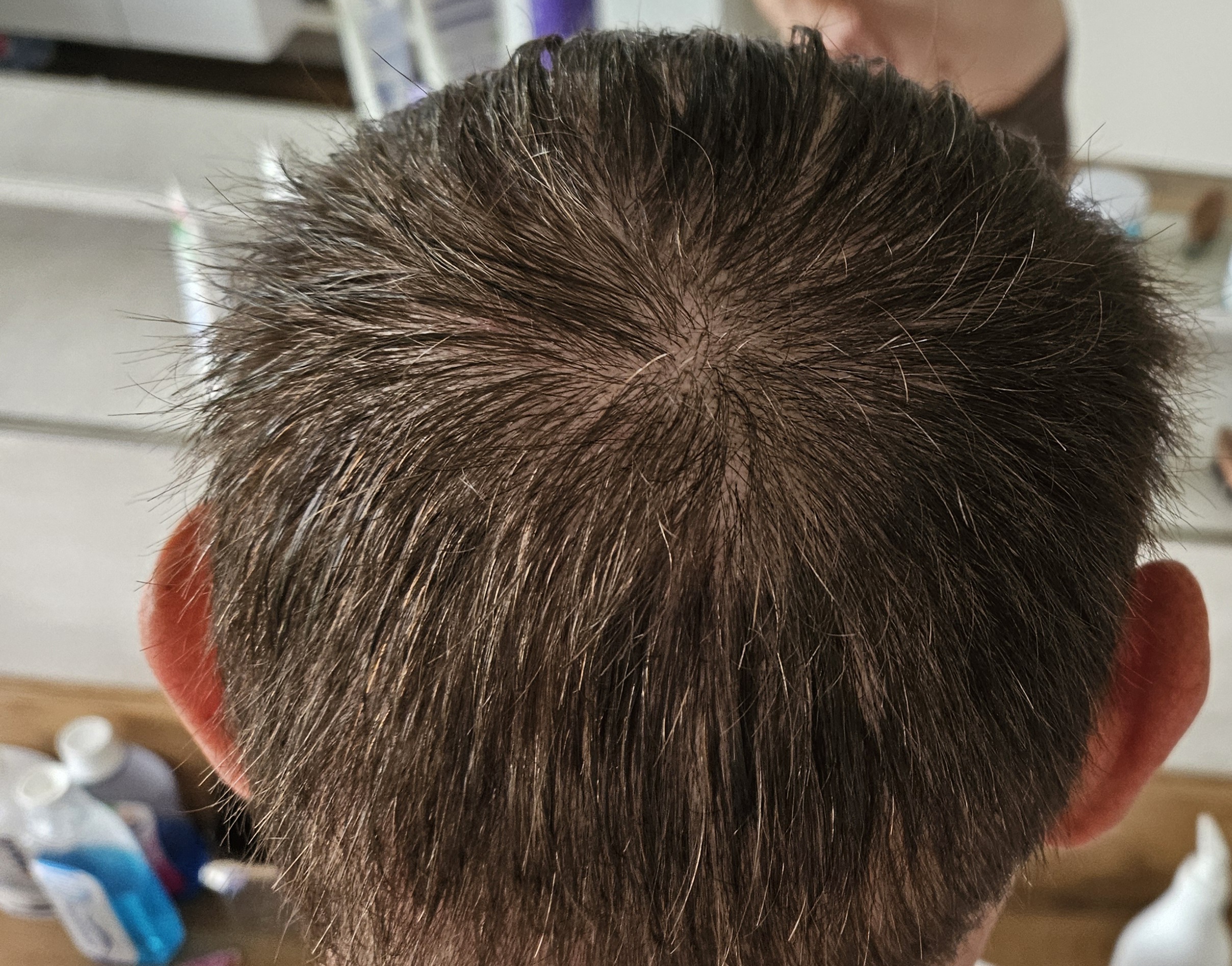 /foren/transplant/index.php/fa/67172/0/