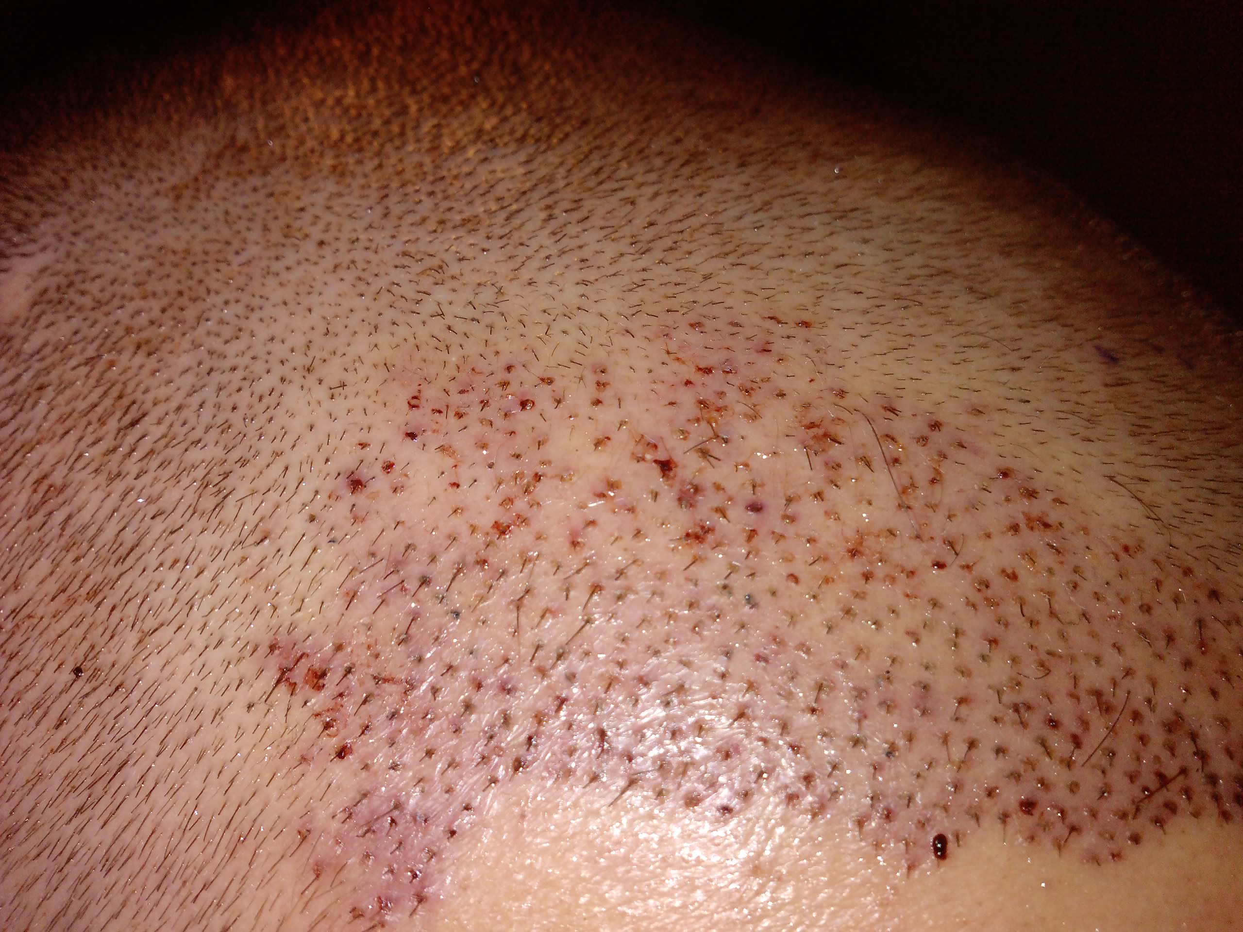 index.php/fa/6723/0/