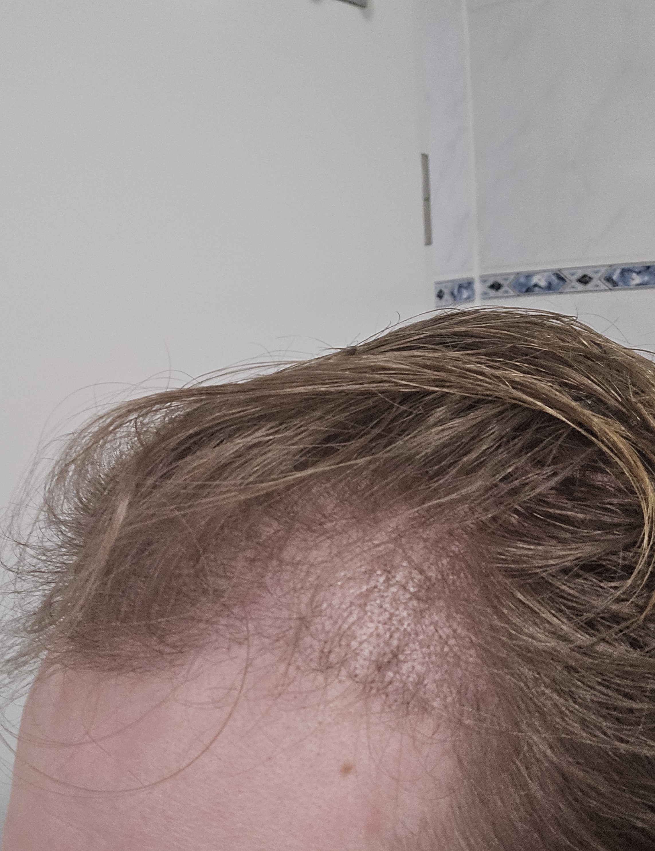 /foren/transplant/index.php/fa/67246/0/