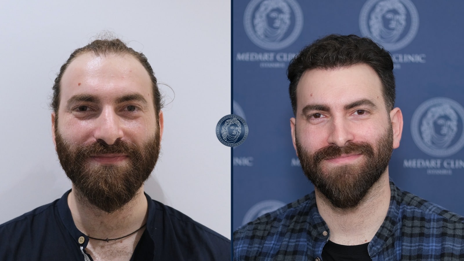 /foren/transplant/index.php/fa/67379/0/