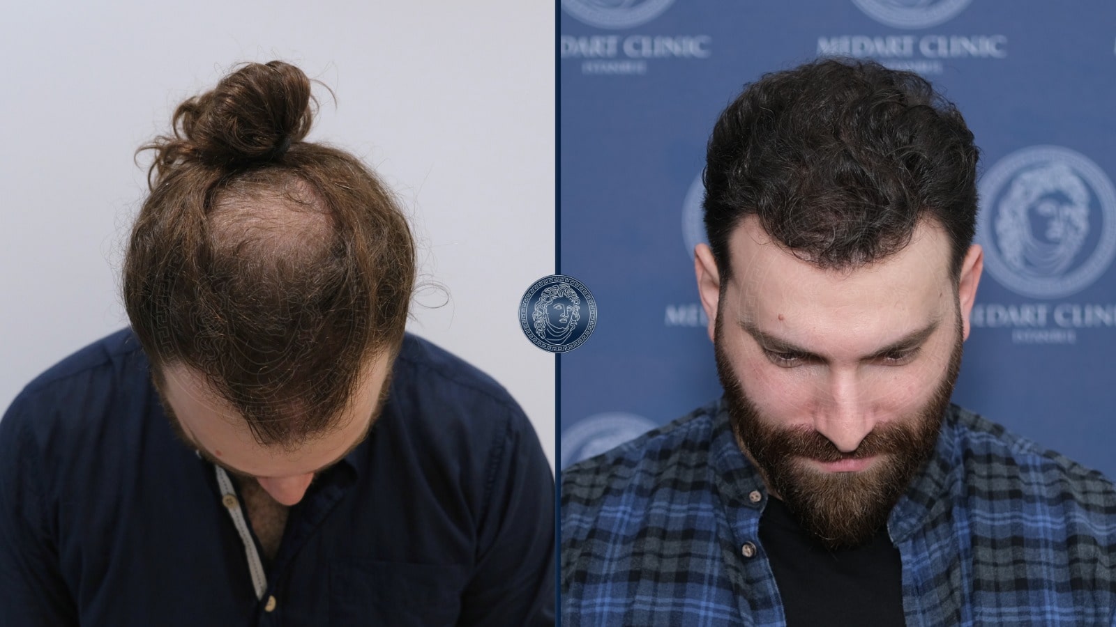 /foren/transplant/index.php/fa/67380/0/