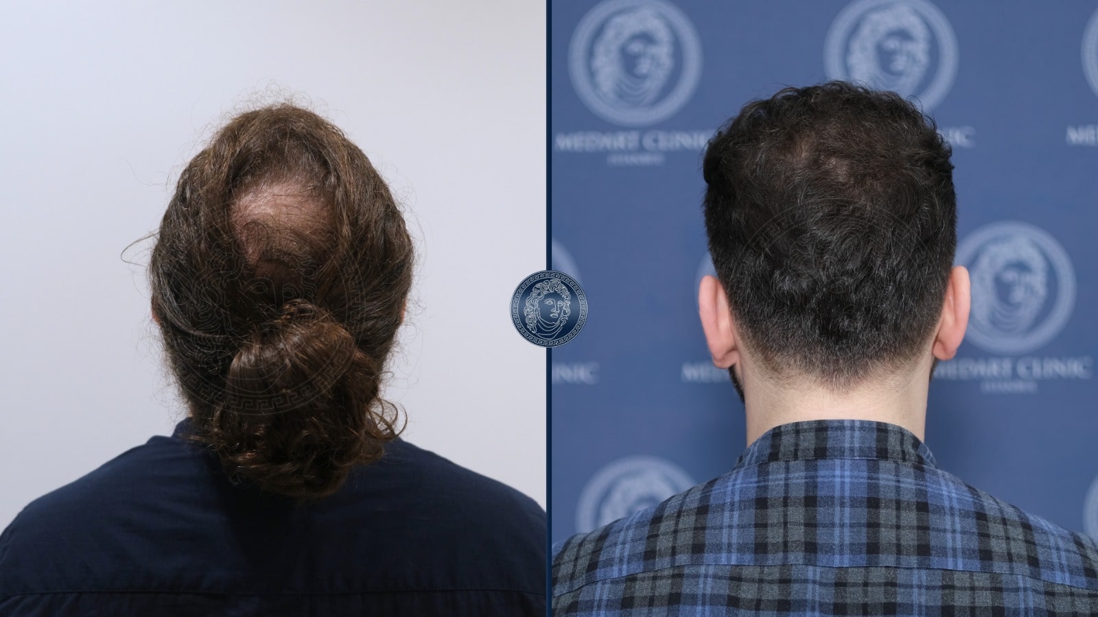 /foren/transplant/index.php/fa/67381/0/